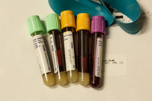 My October blood test